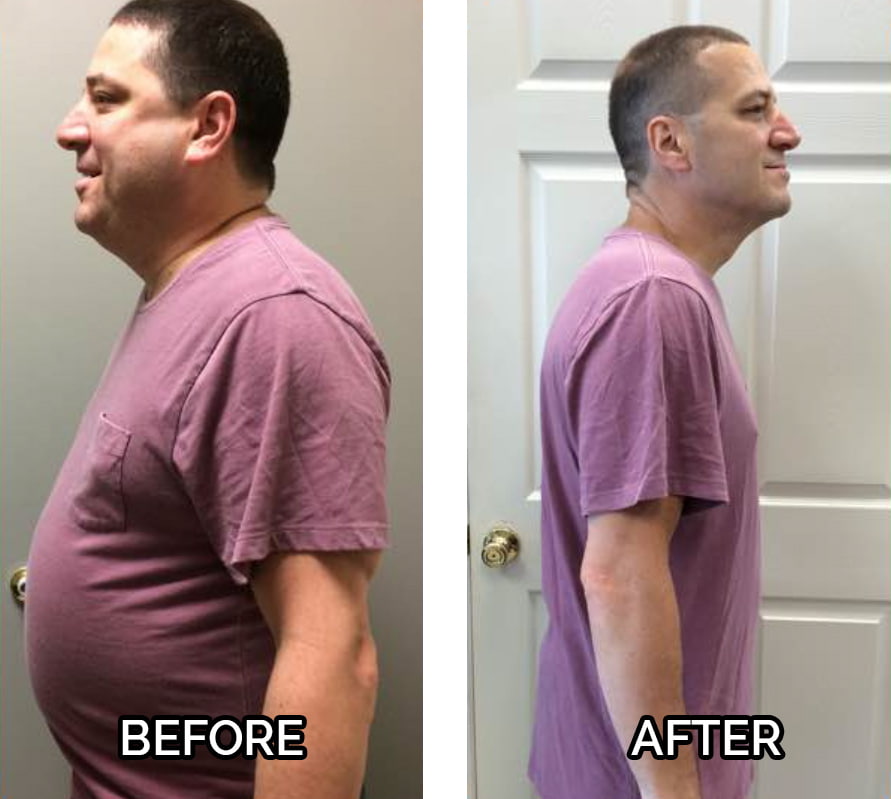 Ronnie Aceto- Lost 63 Pounds