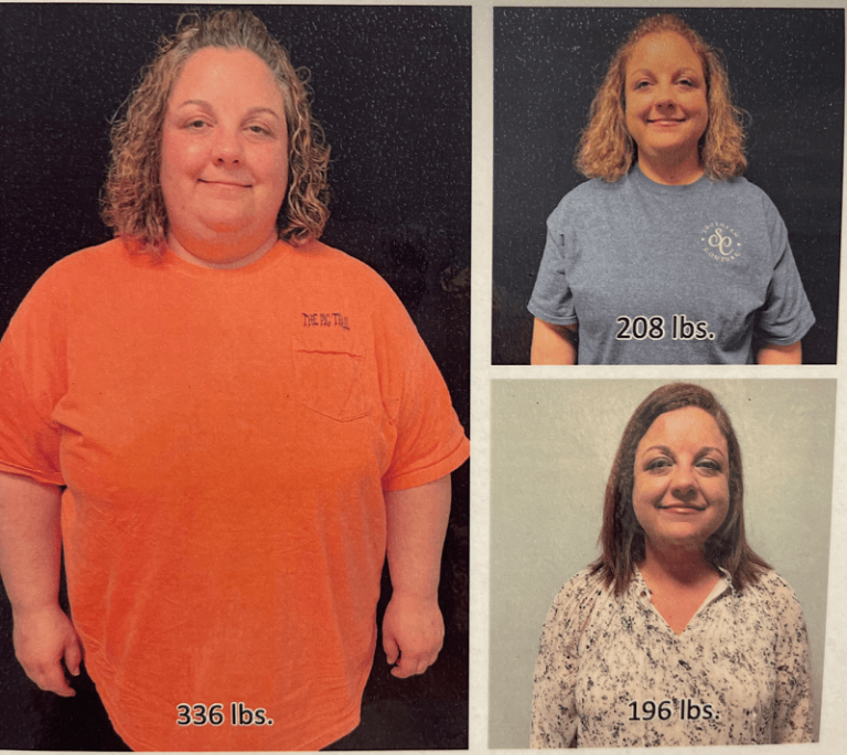 Allison Lost an Amazing 140 Pounds in Collierville, TN